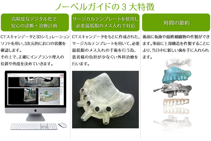 ノーベルガイド3大特徴