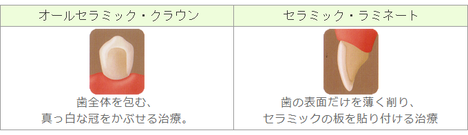 オールセラミックスについて