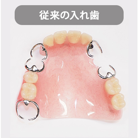 従来の入れ歯