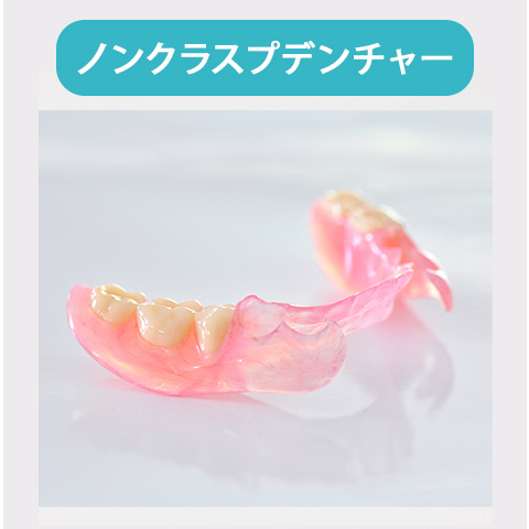 ノンクラスプデンチャー