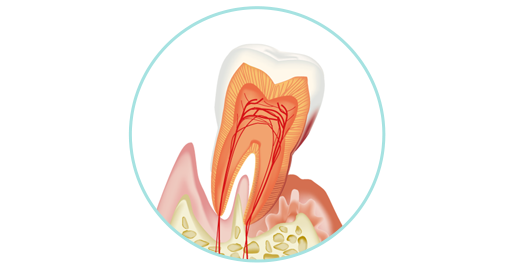 歯周病治療/口臭治療
