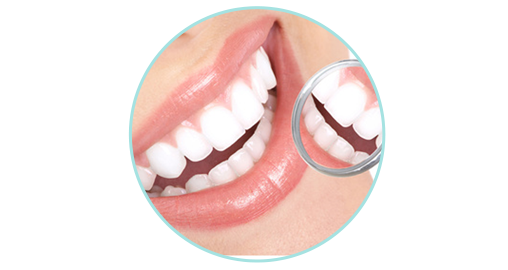 ホワイトニング