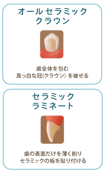 セラミック　イメージ写真