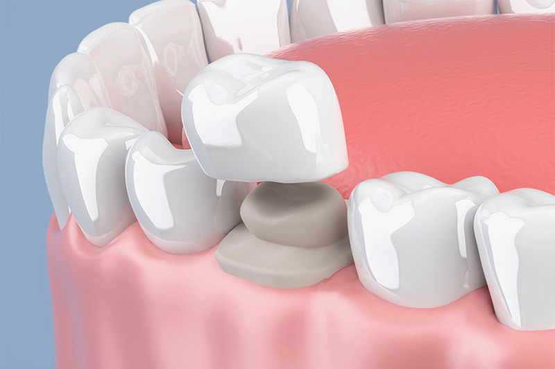 セラミック　イメージ写真