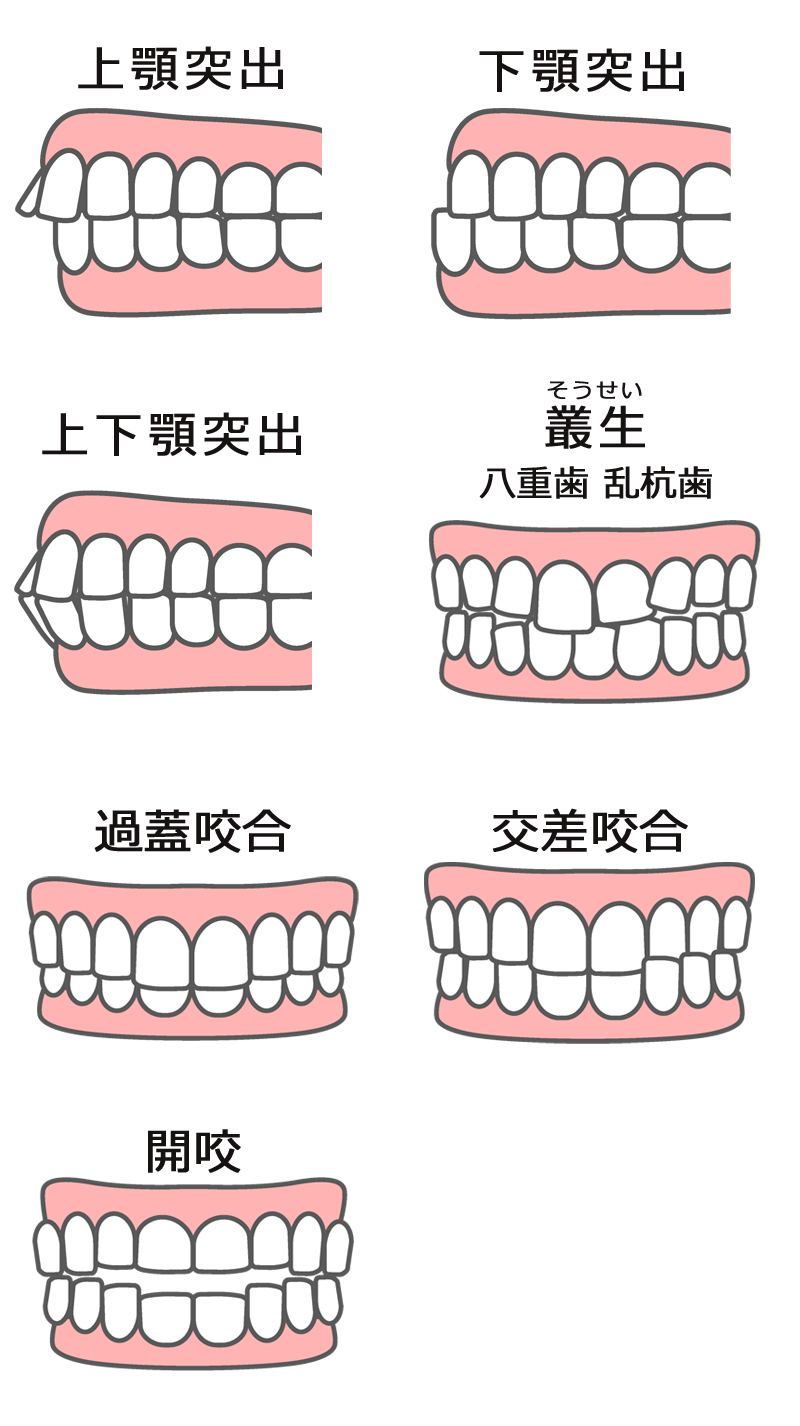 歯並び　イメージ写真