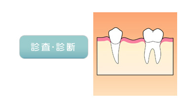 診査・診断