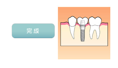 完成