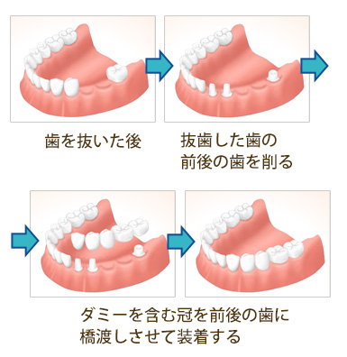 従来の治療法との比較-1