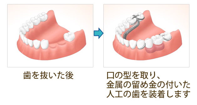 従来の治療法との比較-1