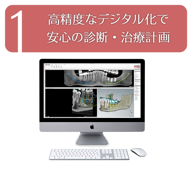 ノーベルガイドの３つの特徴-1