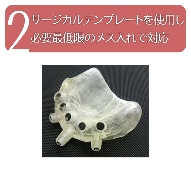 ノーベルガイドの３つの特徴-2